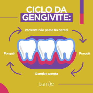 Ciclo da Gengivite