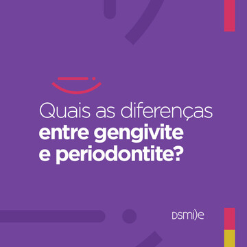 Gengivite vs Periodontite